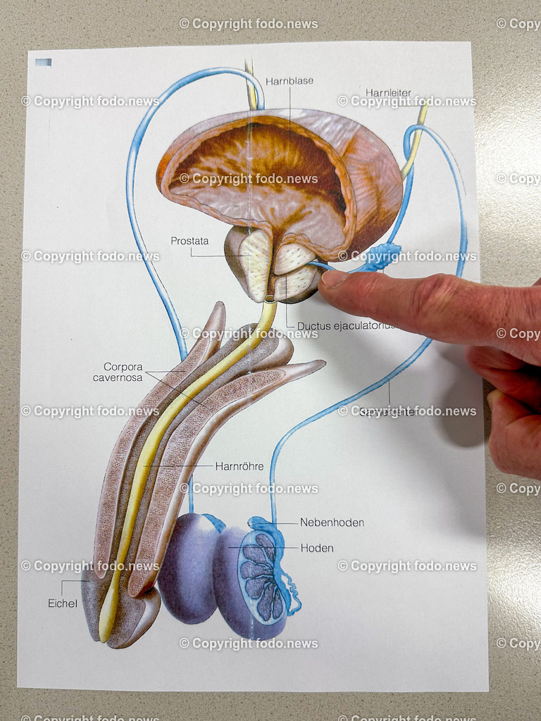 Michael Dunzinger_ Primar_ Salzkammergutklinikum Vöcklabruck_ 19.01.2023-10 | 19.01.2023, Voecklabruck, AUT, Salzkammergutklinikum, im Bild Darstellung der maennlichen Geschlechtsteile mit der Postata