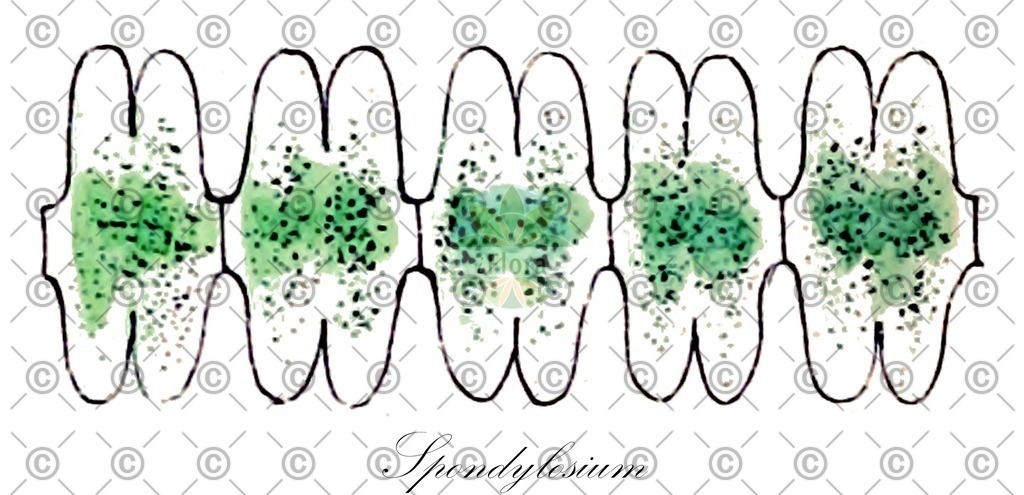 HistAbb_7Q2N5_1_ENZY_Simple | Historische Abbildung von Spondylosium - Desmidiaceae (0) | Historical Illustration of Spondylosium - Desmidiaceae (0)
