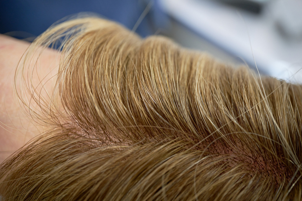 Lace front, ein unsichtbarer Stirnansatz | WIen, Austria - February 02, 2023; Star Perückensalon GmbH.; Lace front, ein unsichtbarer Stirnansatz. - Realisiert mit Pictrs.com