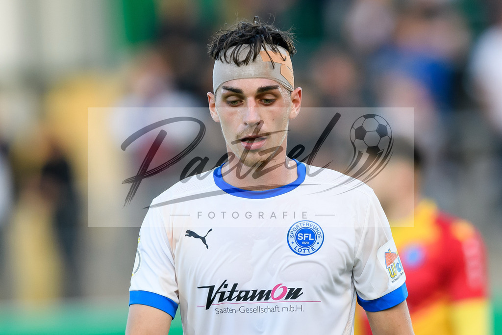 LOTKSC20210809_249 | Fussball, Herren: Luis Allmeroth (Sportfreunde Lotte) schaut beim Spiel der 1. Runde im DFB-Pokal zwischen SF Lotte und Karlsruher SC im Stadion am Lotter Kreuz am 09.08.2021 in Lotte, Deutschland.DFB / DFL REGULATIONS PROHIBIT ANY USE OF PHOTOGRAPHS AS IMAGE SEQUENCES AND/OR QUASI-VIDEO. - Realisiert mit Pictrs.com