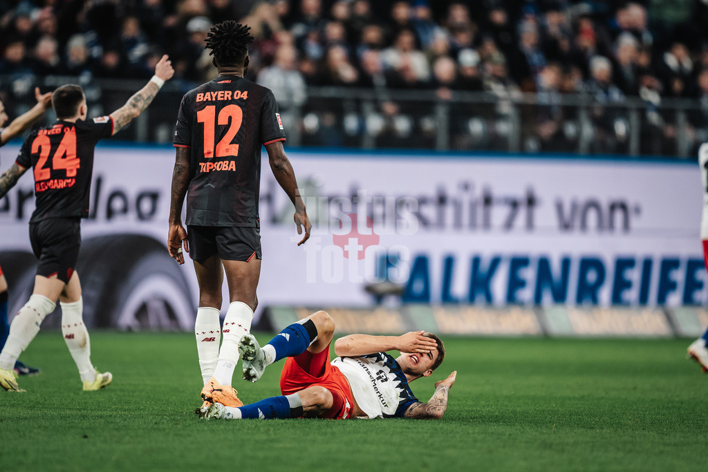 Fußball | Männer | Saison 2025/2026 | 1. Fußball-Bundesliga | 17. Spieltag | Hamburger SV vs. Bayer 04 Leverkusen | 04.03.2026 | Luka Vuskovic (#44, HSV) verletzt sich an der Nase