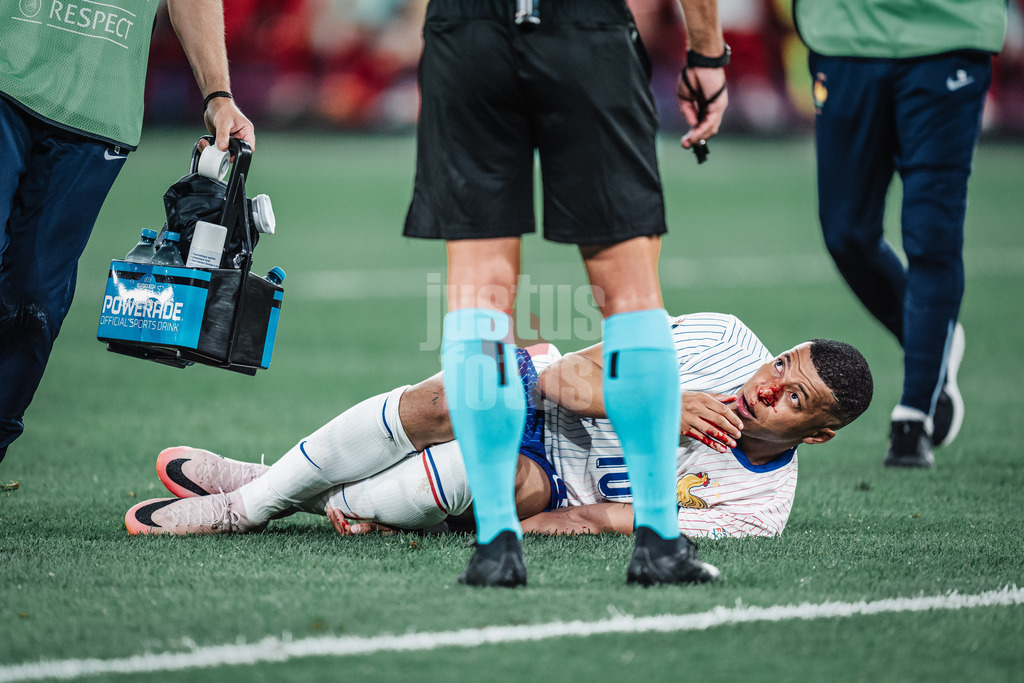 Fußball | Herren | UEFA-Fußball-Europameisterschaft 2024 | Gruppe D | Österreich vs. Frankreich | 17.06.2024 | Kylian Mbappe (#10, Frankreich) blutet und muss aus dem Spiel