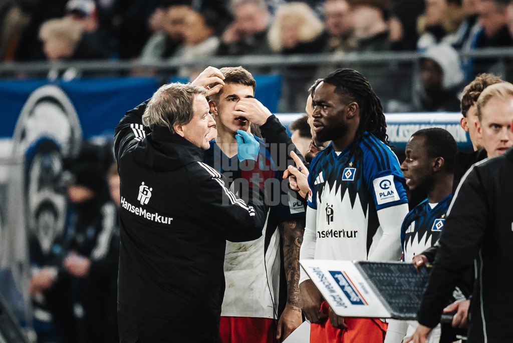 Fußball | Männer | Saison 2025/2026 | 1. Fußball-Bundesliga | 17. Spieltag | Hamburger SV vs. Bayer 04 Leverkusen | 04.03.2026 | Luka Vuskovic (#44, HSV) verletzt sich an der Nase und wird behandelt Blut