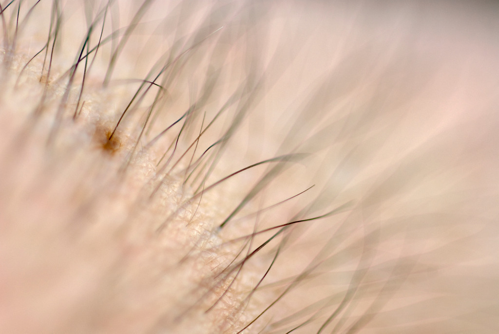 Haare auf dem Arm | Enzersfeld, Austria - May 25, 2010: Haare auf dem Arm. - Realisiert mit Pictrs.com