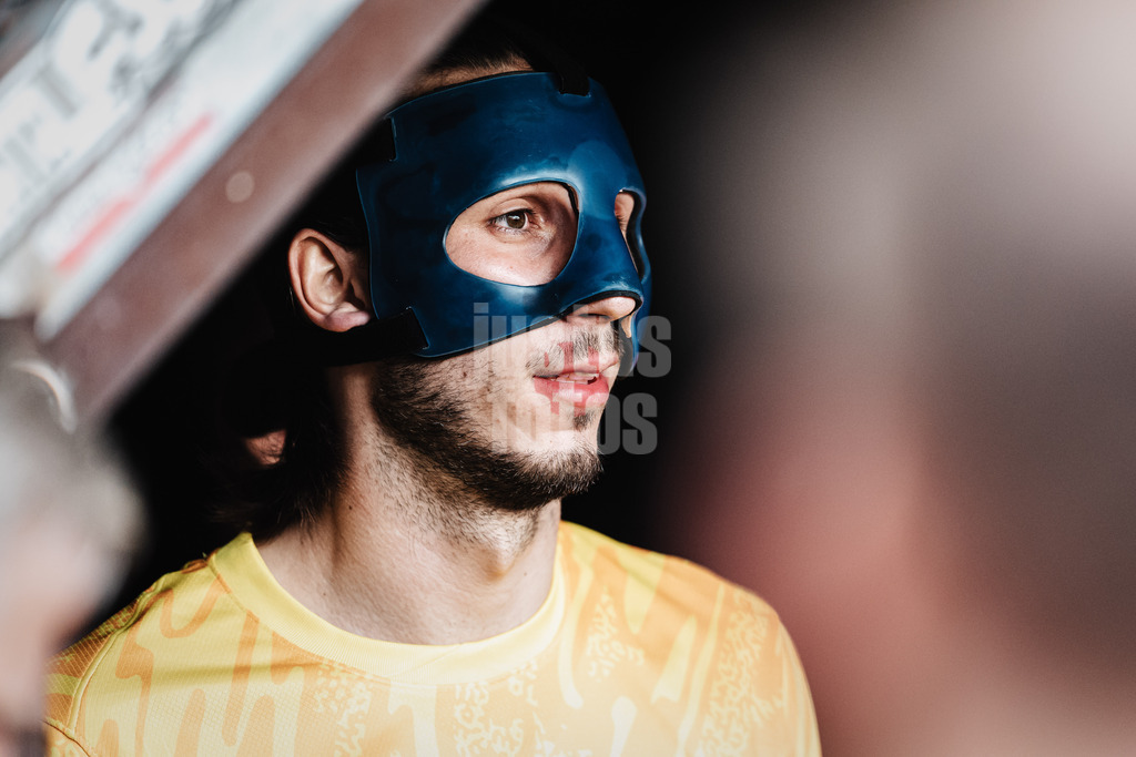 Fußball | Männer | Saison 2024/2025  | Fußball-Bundesliga | 8. Spieltag | FC St. Pauli vs. VfL Wolfsburg | 26.10.2024 | Kamil Grabara (#1, VfL Wolfsburg) mit Maske