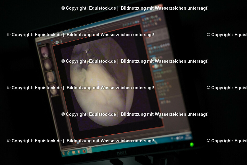 20160315_Arthroskopie_0035 | equistock