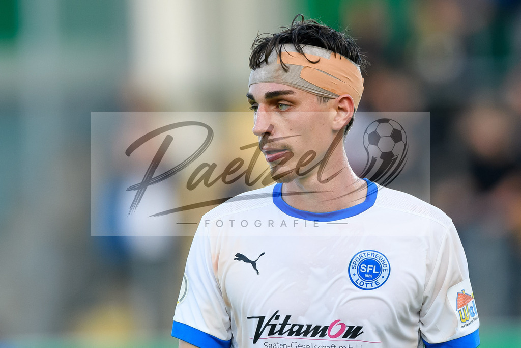 LOTKSC20210809_250 | Fussball, Herren: Luis Allmeroth (Sportfreunde Lotte) schaut beim Spiel der 1. Runde im DFB-Pokal zwischen SF Lotte und Karlsruher SC im Stadion am Lotter Kreuz am 09.08.2021 in Lotte, Deutschland.DFB / DFL REGULATIONS PROHIBIT ANY USE OF PHOTOGRAPHS AS IMAGE SEQUENCES AND/OR QUASI-VIDEO. - Realisiert mit Pictrs.com