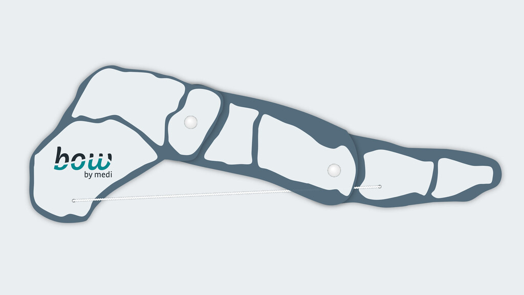 GA-410x173-FOO-bow-ankle-GER-mockup-2 | Fußgelenk