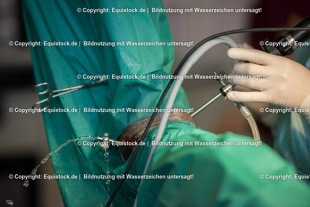 20160315_Arthroskopie_0052 | equistock