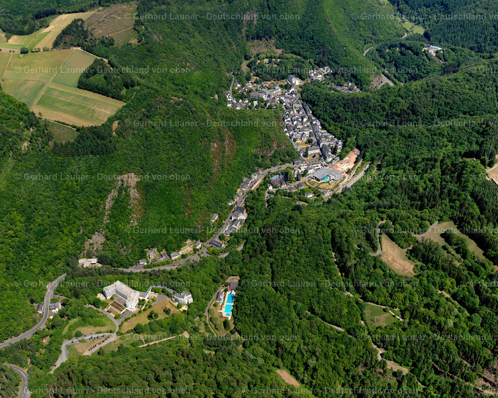 Bad-Bertrich-3114005 | Bad Bertrich