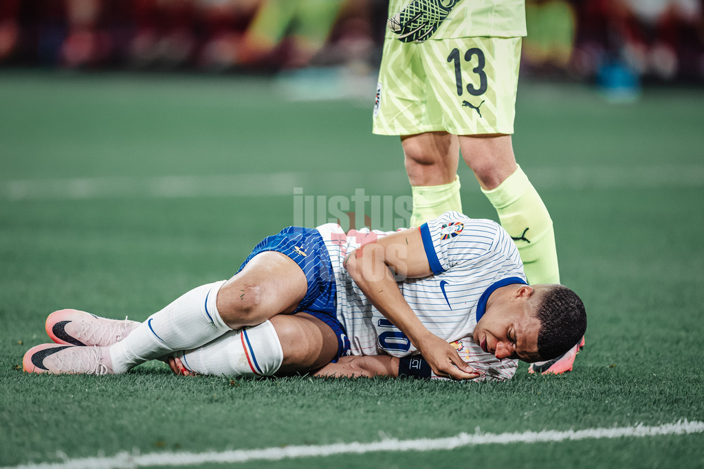 Fußball | Herren | UEFA-Fußball-Europameisterschaft 2024 | Gruppe D | Österreich vs. Frankreich | 17.06.2024 | Kylian Mbappe (#10, Frankreich) blutet und muss aus dem Spiel